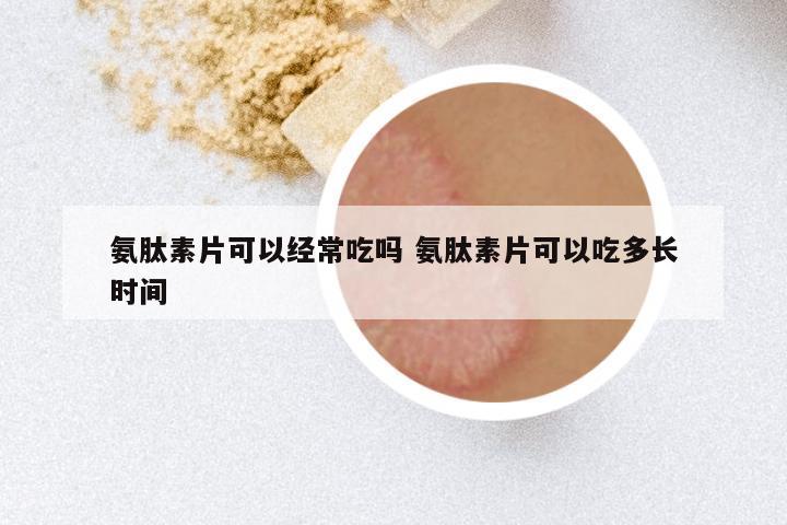 氨肽素片可以经常吃吗 氨肽素片可以吃多长时间