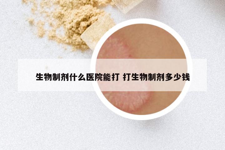 生物制剂什么医院能打 打生物制剂多少钱