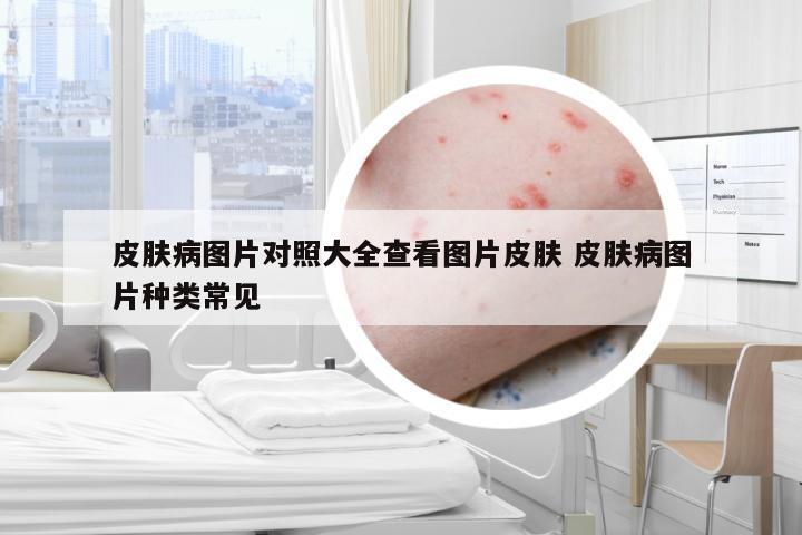 皮肤病图片对照大全查看图片皮肤 皮肤病图片种类常见