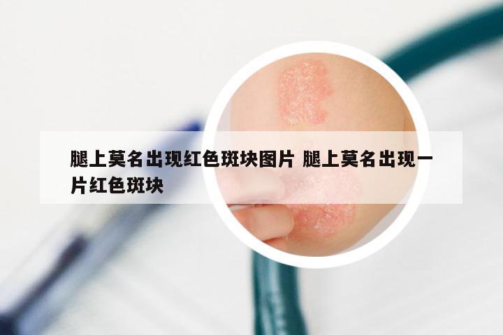 腿上莫名出现红色斑块图片 腿上莫名出现一片红色斑块