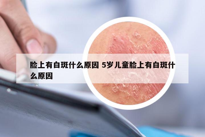 脸上有白斑什么原因 5岁儿童脸上有白斑什么原因