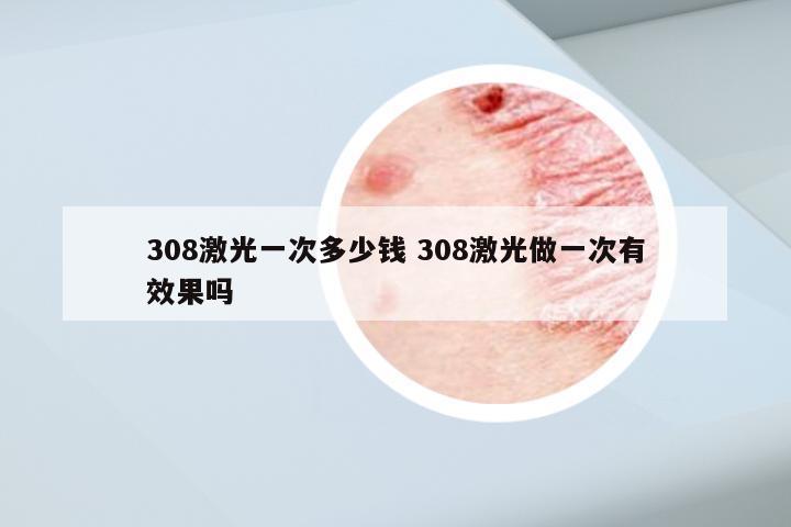 308激光一次多少钱 308激光做一次有效果吗