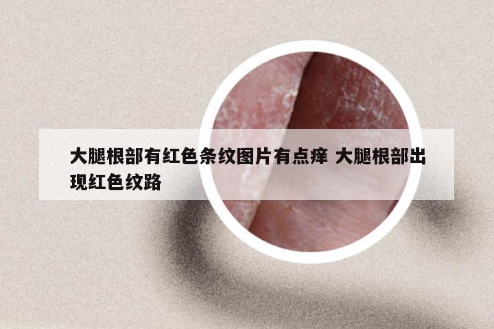 大腿根部有红色条纹图片有点痒 大腿根部出现红色纹路