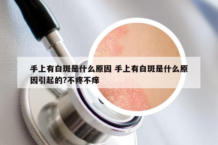 手上有白斑是什么原因 手上有白斑是什么原因引起的?不疼不痒