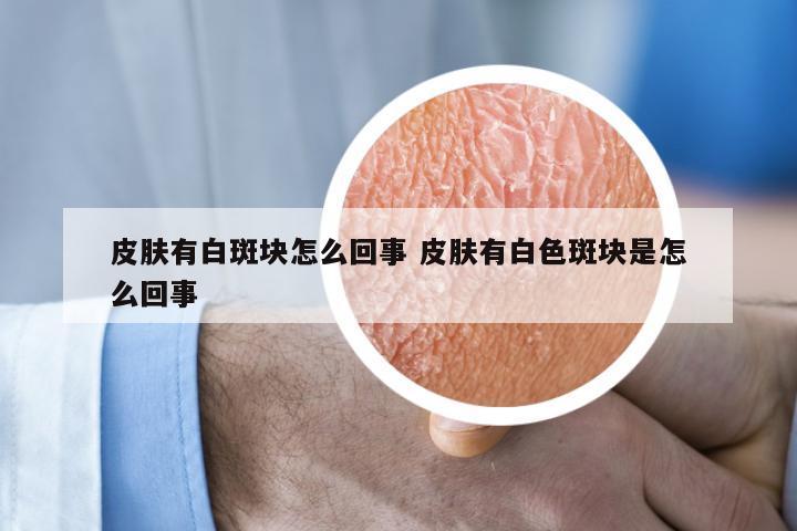 皮肤有白斑块怎么回事 皮肤有白色斑块是怎么回事