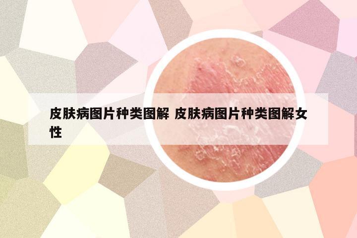 皮肤病图片种类图解 皮肤病图片种类图解女性