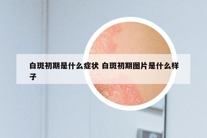 白斑初期是什么症状 白斑初期图片是什么样子