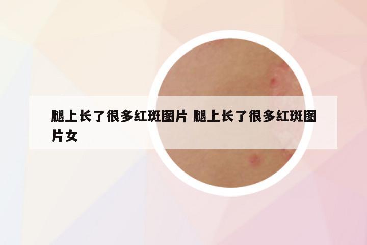 腿上长了很多红斑图片 腿上长了很多红斑图片女