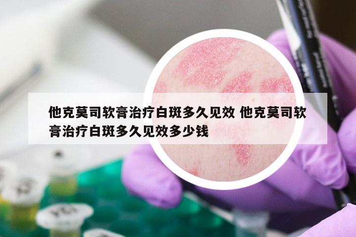 他克莫司软膏治疗白斑多久见效 他克莫司软膏治疗白斑多久见效多少钱