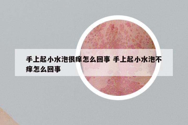 手上起小水泡很痒怎么回事 手上起小水泡不痒怎么回事