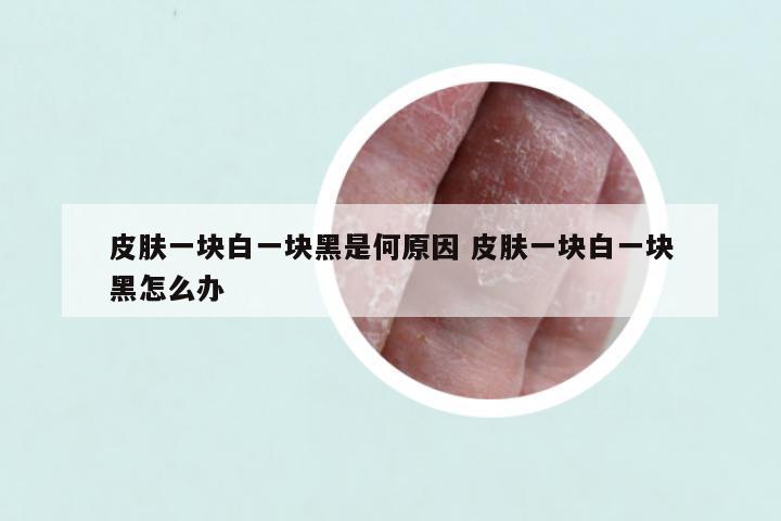 皮肤一块白一块黑是何原因 皮肤一块白一块黑怎么办