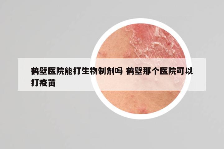 鹤壁医院能打生物制剂吗 鹤壁那个医院可以打疫苗