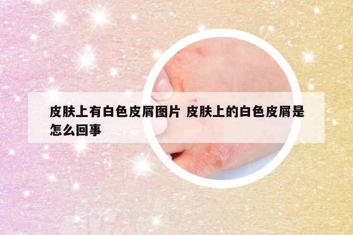 皮肤上有白色皮屑图片 皮肤上的白色皮屑是怎么回事