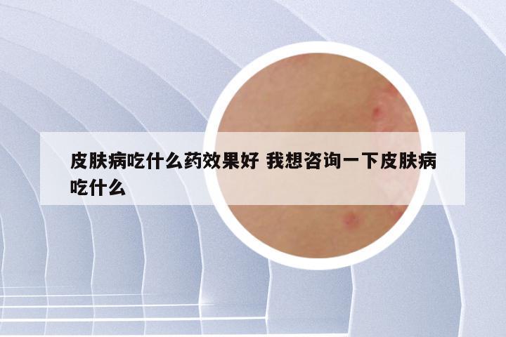 皮肤病吃什么药效果好 我想咨询一下皮肤病吃什么