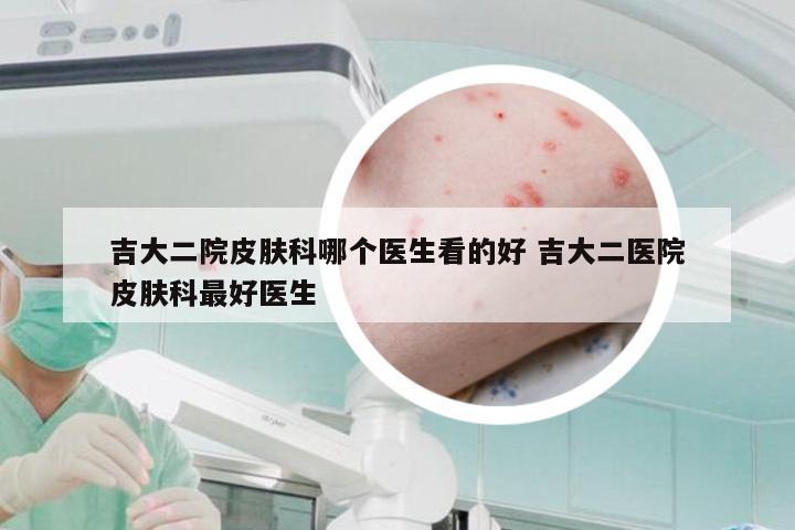 吉大二院皮肤科哪个医生看的好 吉大二医院皮肤科最好医生