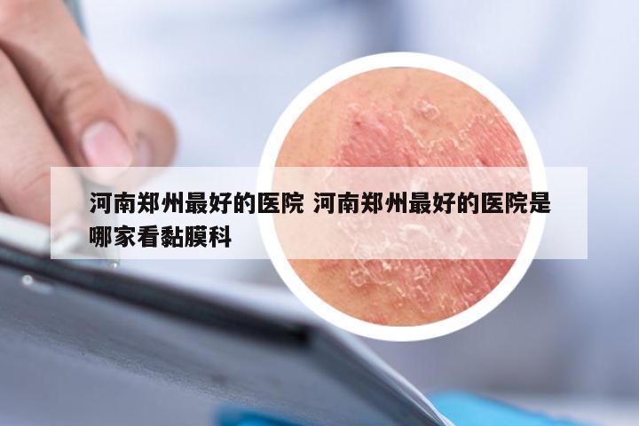河南郑州最好的医院 河南郑州最好的医院是哪家看黏膜科