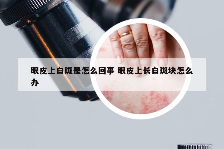 眼皮上白斑是怎么回事 眼皮上长白斑块怎么办