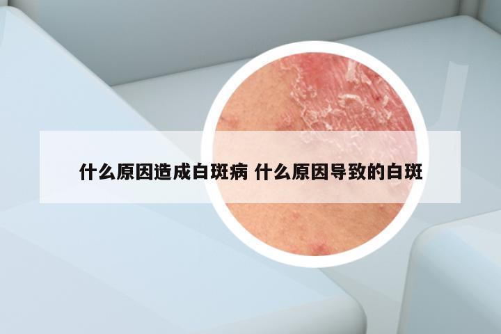 什么原因造成白斑病 什么原因导致的白斑