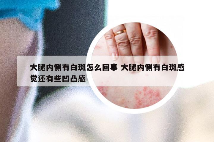 大腿内侧有白斑怎么回事 大腿内侧有白斑感觉还有些凹凸感