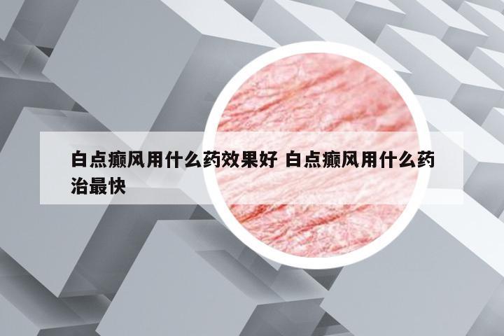 白点癫风用什么药效果好 白点癫风用什么药治最快