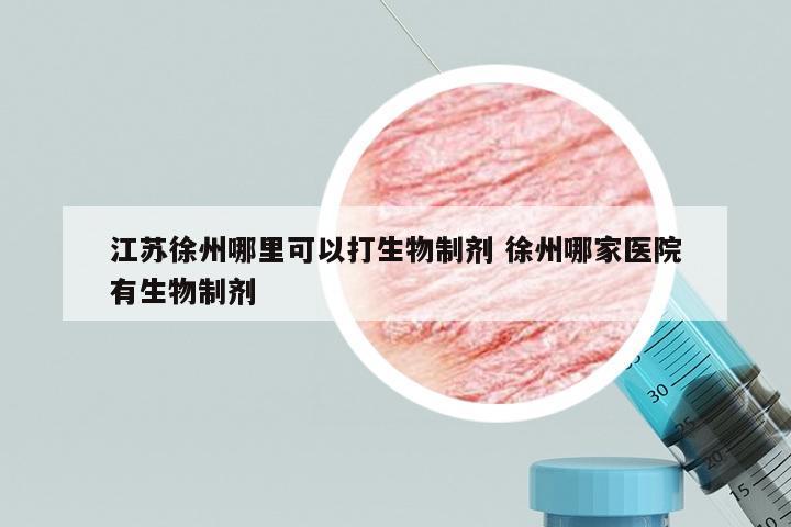 江苏徐州哪里可以打生物制剂 徐州哪家医院有生物制剂