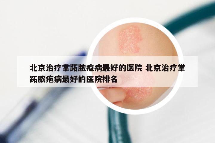 北京治疗掌跖脓疱病最好的医院 北京治疗掌跖脓疱病最好的医院排名