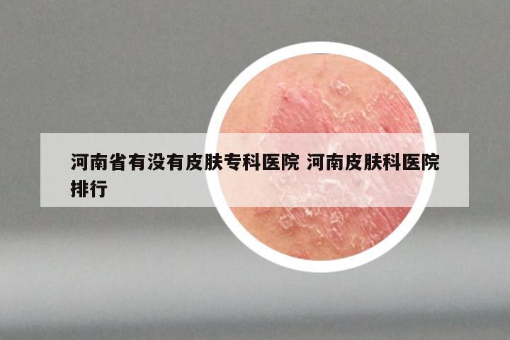 河南省有没有皮肤专科医院 河南皮肤科医院排行