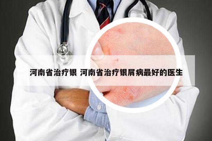 河南省治疗银 河南省治疗银屑病最好的医生