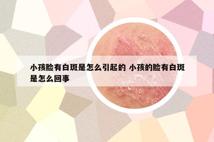 小孩脸有白斑是怎么引起的 小孩的脸有白斑是怎么回事