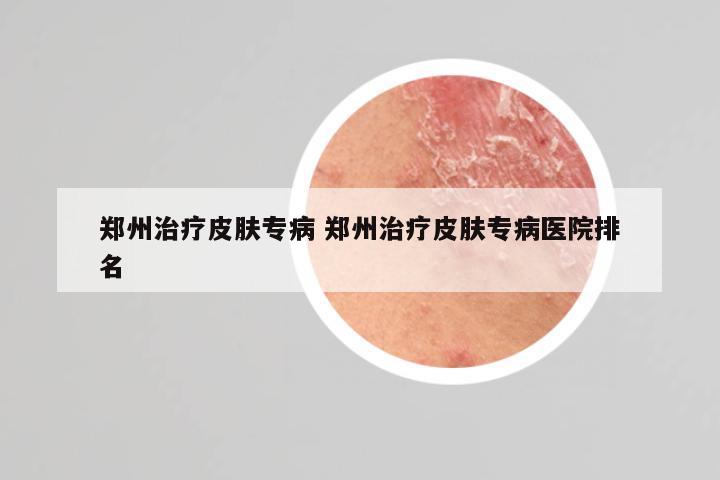 郑州治疗皮肤专病 郑州治疗皮肤专病医院排名