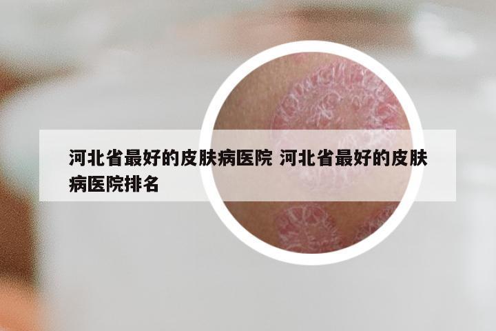 河北省最好的皮肤病医院 河北省最好的皮肤病医院排名