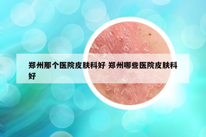 郑州那个医院皮肤科好 郑州哪些医院皮肤科好