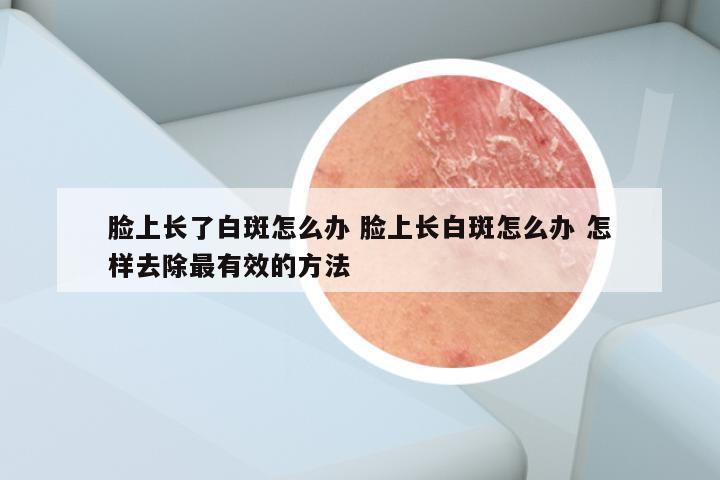 脸上长了白斑怎么办 脸上长白斑怎么办 怎样去除最有效的方法