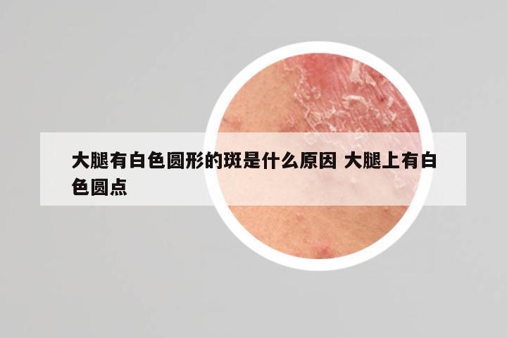 大腿有白色圆形的斑是什么原因 大腿上有白色圆点