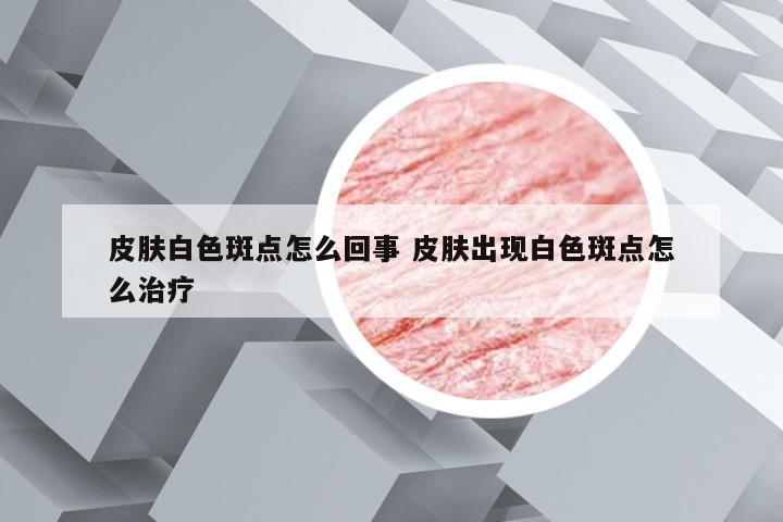 皮肤白色斑点怎么回事 皮肤出现白色斑点怎么治疗