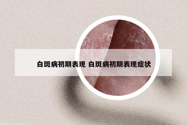 白斑病初期表现 白斑病初期表现症状