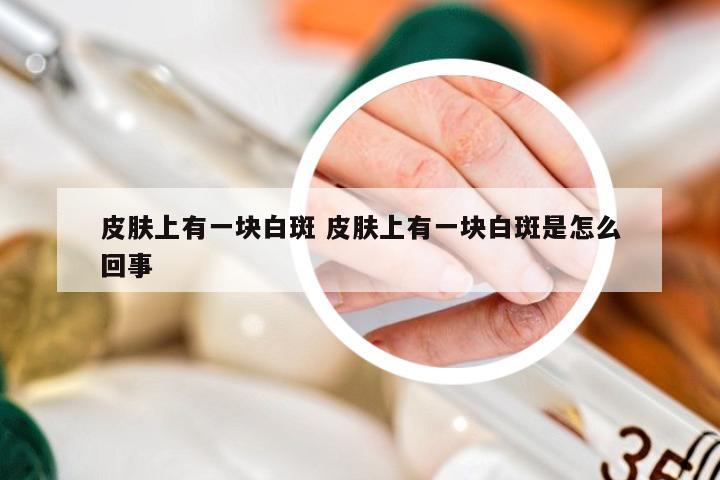 皮肤上有一块白斑 皮肤上有一块白斑是怎么回事