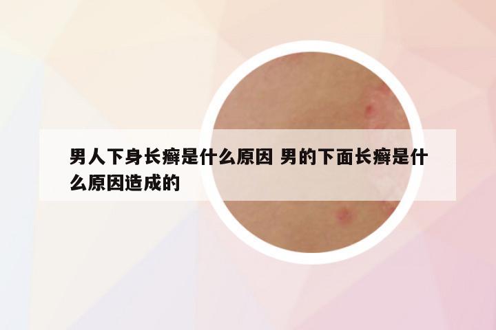 男人下身长癣是什么原因 男的下面长癣是什么原因造成的