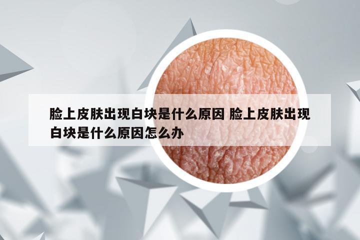 脸上皮肤出现白块是什么原因 脸上皮肤出现白块是什么原因怎么办