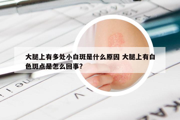 大腿上有多处小白斑是什么原因 大腿上有白色斑点是怎么回事?