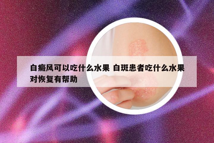 白癜风可以吃什么水果 白斑患者吃什么水果对恢复有帮助