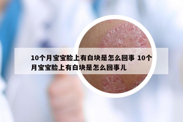 10个月宝宝脸上有白块是怎么回事 10个月宝宝脸上有白块是怎么回事儿