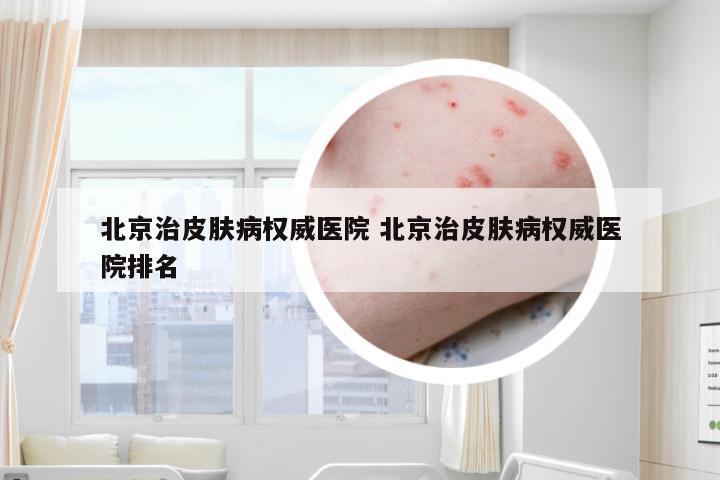 北京治皮肤病权威医院 北京治皮肤病权威医院排名