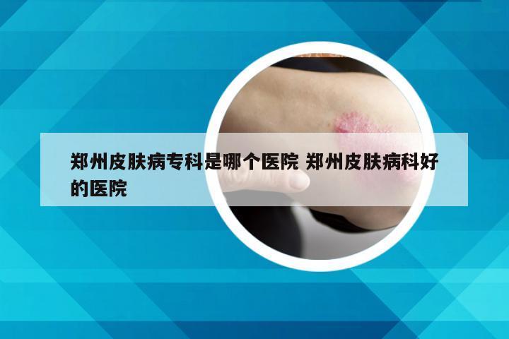 郑州皮肤病专科是哪个医院 郑州皮肤病科好的医院