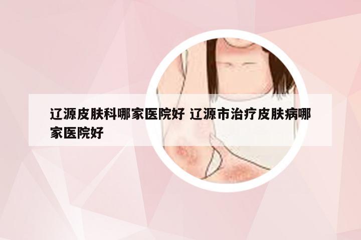 辽源皮肤科哪家医院好 辽源市治疗皮肤病哪家医院好