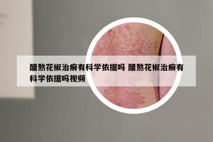 醋熬花椒治癣有科学依据吗 醋熬花椒治癣有科学依据吗视频