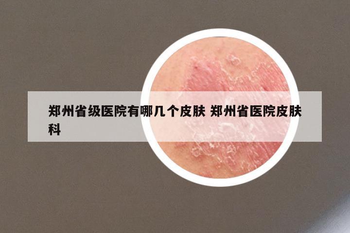 郑州省级医院有哪几个皮肤 郑州省医院皮肤科