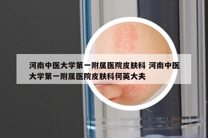 河南中医大学第一附属医院皮肤科 河南中医大学第一附属医院皮肤科何英大夫
