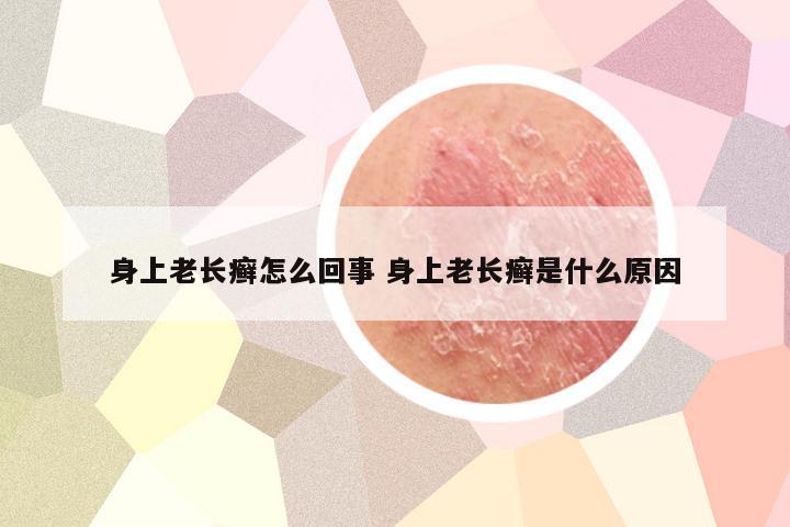 身上老长癣怎么回事 身上老长癣是什么原因