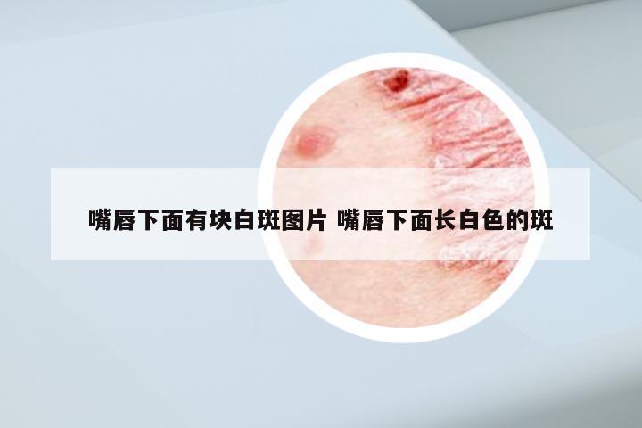 嘴唇下面有块白斑图片 嘴唇下面长白色的斑